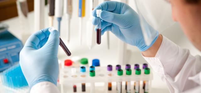 Bioquimicos