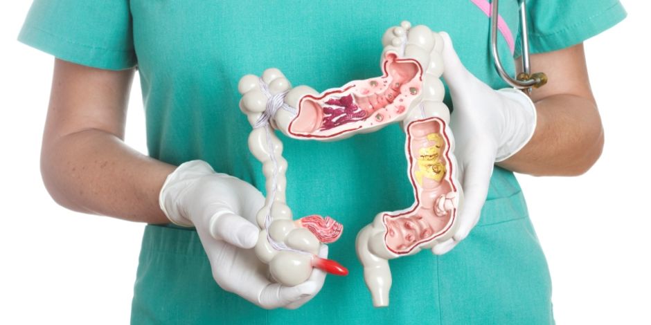 cancer-colorrectal